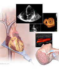 Book an Appointment with Echocardiography - Vascular Imaging for Trinity Heart and Vascular Group: Cardiovascular Medicine (Cardiology)